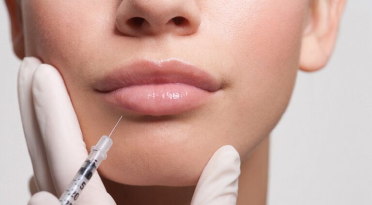 الشفاه المثالية!