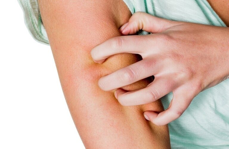 احذر الحكة بعد الاستحمام!