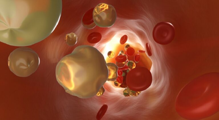 نصائح لخفض مستويات الكوليسترول