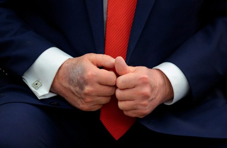 إشاعات حول صحة ترامب