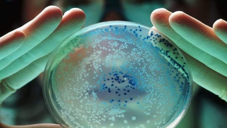 داء الفيالقة يحصد ضحيته الخامسة!