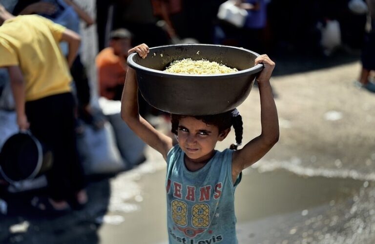 ارتفاع وفيات سوء التغذية في غزة إلى 393 بينهم 140 طفلا