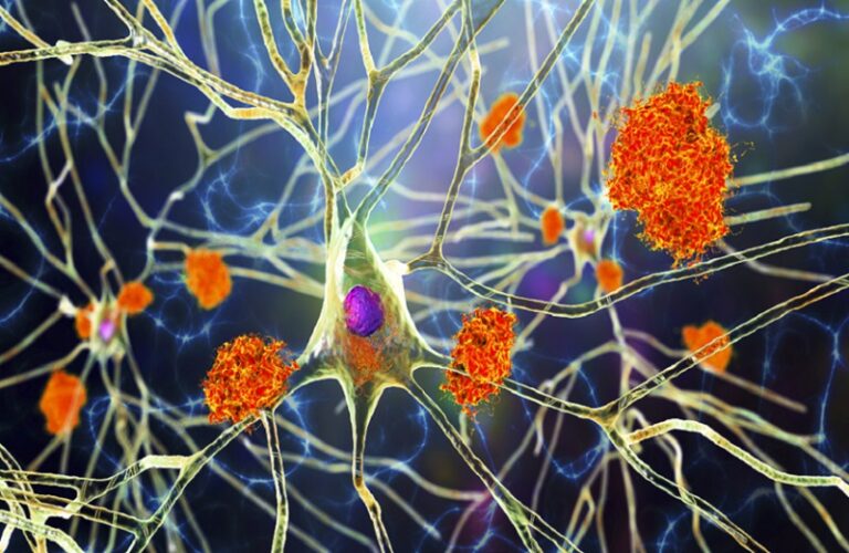 بروتين TSPO مفتاحاً واعداً للكشف المبكر عن ألزهايمر؟
