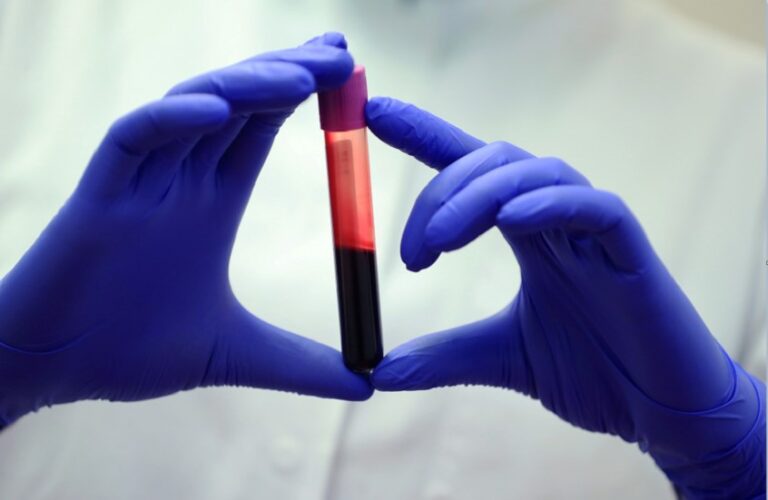 فحص دم عالمي يشخّص التعب المزمن!