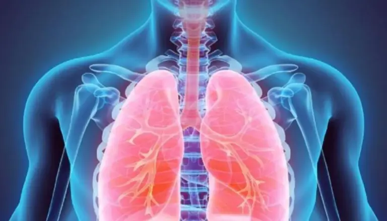 أطعمة مصنعة تزيد خطر سرطان الرئة!