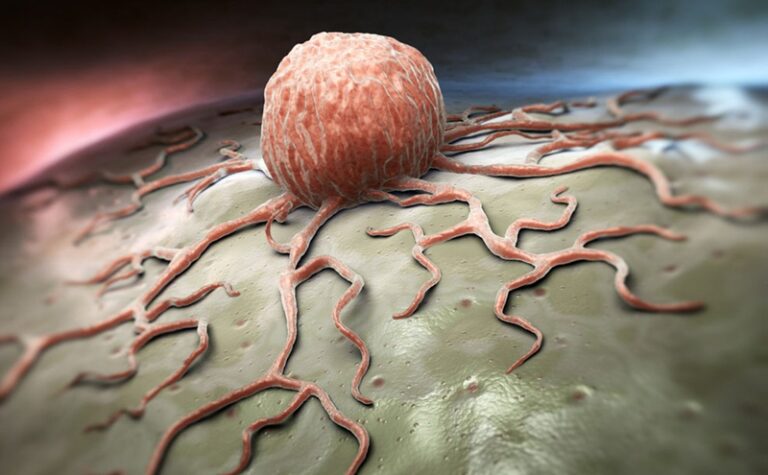 لبنان.. أرض خصبة للسرطان!